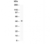 Western blot testing of p73 antibody and recombinant human protein (0.5ng)