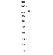 Western blot testing of ZEB2 antibody and SMMC-7721 lysate.  Predicted molecular weight  120~136 kDa.