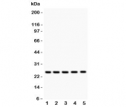 Western blot testing of HSP27 antibody and Lane 1:  rat NRK;  2: human HeLa;  3: (h) A549;  4: (h) COLO320;  5: (h) HEPG2 lysate.  Expected molecular weight: 23-27 kDa.
