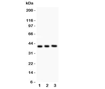 Western blot testing of Fetuin A antibody and Lane 1: NIH3T3; 2: Neuro-2a; 3: mouse brain lysate. Predicted/observed size ~39KD~