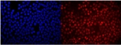 Immunofluorescent staining of FFPE human A431 cells with RACK1 antibody (red) and DAPI nuclear stain (blue). HIER: steam section in pH6 citrate buffer for 20 min.