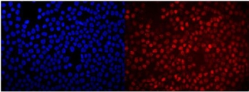 Immunofluorescent staining of FFPE human A431 cells with RACK1 antibody (red) and DAPI nuclear stain (blue). HIER: steam section in pH6 citrate buffer for 20 min.