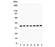 Western blot testing of RACK1 antibody and Lane 1:  mouse liver;  2: rat spleen;  3: (m) spleen;  4: human SMMC-7721;  5: (h) HEPG2;  6: (m) HEPA;  7: (r) RH35 lysate.  Predicted molecular weight: ~35 kDa.