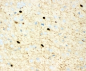 IHC-P: Calretinin antibody testing of mouse brain tissue