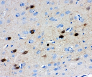 IHC-P: Calretinin antibody testing of rat brain tissue