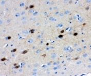 IHC-P: Calretinin antibody testing of rat brain tissue