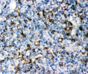 IHC-P: CD8 antibody testing of human tonsil tissue.