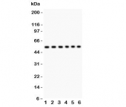 Western blot testing of CD8 antibody and Lane 1:  Jurkat;  2: Raji;  3: HL-60;  4: A549;  5: COLO320;  6: HeLa lysate;  Predicted molecular weight ~34 kDa;  Observed molecular weight: 34~60 kDa depending on glycosylation level.