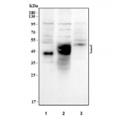 Western blot testing of human 1) MDA-MB-453, 2) U-87 MG and 3) HL-60 cell lysate with CD63 antibody. Expected molecular weight: 26-60 kDa depending on the level of glycosylation.