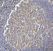IHC staining of FFPE human tonsil tissue with CD86 antibody. HIER: boil tissue sections in pH8 EDTA for 20 min and allow to cool before testing.