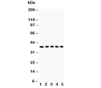 Western blot testing of Fas antibody and Lane 1: HeLa; 2: Jurkat; 3: A549; 4: SMMC-7721; 5: K562 lysate