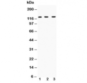 Western blot testing of HIF-1 alpha antibody and Lane 1:  human HeLa;  2: human SHG-44;  3: mouse HEPA1-6;  Routinely observed molecular weight: 100~120 kDa.