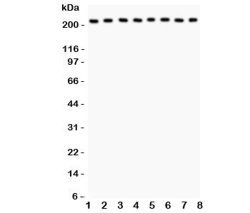 Western blot testing of Integrin alpha 5 antibody and Lane 1: rat brain; 2: mouse brain; 3: human MM231; 4: (h) HeLa; 5: (h) Jurkat; 6: (h) 293T; 7: (m) Neuro-2a; 8: (r) PC12 lysate; Expected size: 115-160KD; Observed size: 220KD~