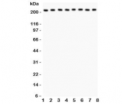 Western blot testing of Integrin alpha 5 antibody and Lane 1:  rat brain;  2: mouse brain;  3: human MM231;  4: (h) HeLa;  5: (h) Jurkat;  6: (h) 293T;  7: (m) Neuro-2a;  8: (r) PC12 lysate;  Expected molecular weight: 115-160 kDa, observed here at ~220 kDa.