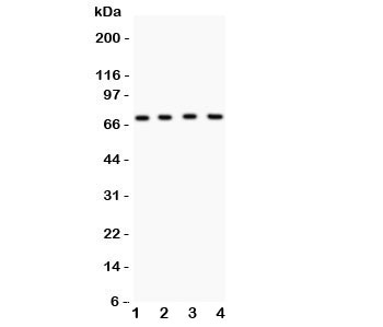 Western blot testing of Kv4.1 antibody and Lane 1: mouse brain; 2: human HeLa; 3: (h) COLO320; 4: (h) A549 lysate. Predicted/observed size ~71KD~