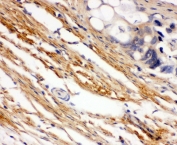 IHC-P: c-Kit antibody testing of human intestinal cancer tissue