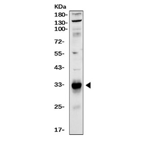Western blot testing of human LNCaP cell lysate with PSA antibody. Expected molecular weigh