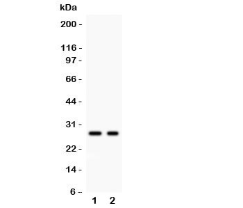 Western blot testing of Kallikrein 4 antibody and Lane 1: 293T; 2: MCF-7 lysate. Predicted size ~27KD, observed size 27~32KD~
