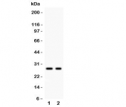 Western blot testing of Kallikrein 4 antibody and Lane 1:  293T;  2: MCF-7 lysate.  Predicted size ~27KD, observed size 27~32KD