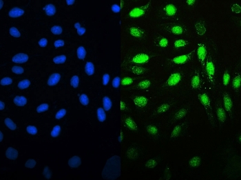Immunofluorescent staining of FFPE human U-2 OS cells with MCM7 antibody (green) and DAPI nuclear stain (blue). HIER: steam section in pH6 citrate buffer for 20 min.