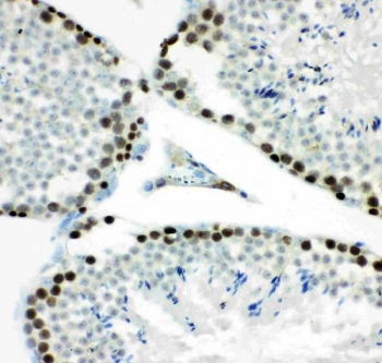 IHC staining of FFPE mouse testis tissue with MCM7 antibody. HIER: boil tissue sections in pH8 EDTA for 20 min and allow to cool before testing.
