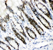 IHC staining of FFPE rat intestinal tissue with MCM7 antibody. HIER: boil tissue sections in pH8 EDTA for 20 min and allow to cool before testing.