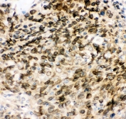 IHC staining of FFPE human intestine with MAD1 antibody. HIER: boil tissue sections in pH6, 10mM citrate buffer, for 20 min and allow to cool before testing.
