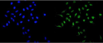 Immunofluorescent staining of FFPE human U-2 OS cells with MAD1 antibody (green) and DAPI nuclear stain (blue). HIER: steam section in pH6 citrate buffer for 20 min.