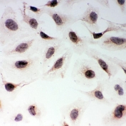 ICC staining of FFPE human HeLa cells with MAD1 antibody. HIER: boil tissue sections in pH6, 10mM citrate buffer, for 20 min and allow to cool before testing.
