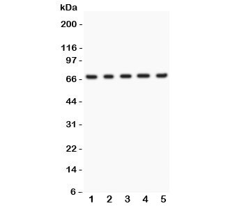 Western blot testing of Menin antibody and Lane 1: human HeLa; 2: (h) 293T; 3: (h) SMMC-7721; 4: mouse HEPA; 5: (h) COLO320. Predicted/observed size ~68KD~