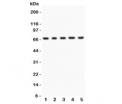 Western blot testing of Menin antibody and Lane 1:  human HeLa;  2: (h) 293T;  3: (h) SMMC-7721;  4: mouse HEPA1-6;  5: (h) COLO320.  Predicted molecular weight ~68 kDa.