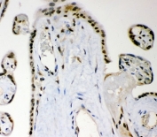 IHC-P: MGMT antibody testing of human placenta tissue. HIER: steam section in pH6 citrate buffer for 20 min.