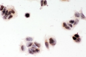 ICC staining of FFPE human MCF7 cells with MGMT antibody. HIER: boil tissue sections in pH6, 10mM citrate buffer, for 20 min and allow to cool before testing.