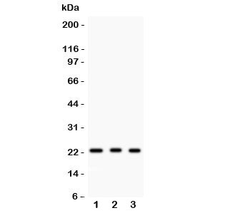 Western blot testing of MGMT antibody and human samples 1: HeLa; 2: placenta; 3: Jurkat. Predicted molecular weight: ~23 kDa.