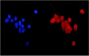 Immunofluorescent staining of FFPE human MCF7 cells with MGMT antibody (red) and DAPI nuclear stain (blue). HIER: steam section in pH6 citrate buffer for 20 min.