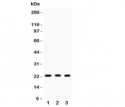 Western blot testing of MGMT antibody and human samples 1:  HeLa;  2: placenta;  3: Jurkat.  Predicted molecular weight: ~23 kDa.