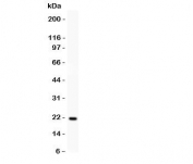 Western blot testing of MGMT antibody and recombinant human protein (0.5ng).