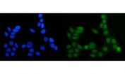 Immunofluorescent staining of FFPE human MCF7 cells with MGMT antibody (green) and DAPI nuclear stain (blue). HIER: steam section in pH6 citrate buffer for 20 min.