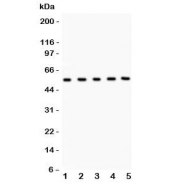 Western blot testing of MMP3 antibody and Lane 1:  human placenta;  2: U20S;  3: HeLa;  4: PANC;  5: COLO320. Predicted molecular weight ~54 kDa.