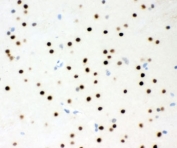 IHC staining of FFPE rat brain tissue with MSK1 antibody. HIER: boil tissue sections in pH8 EDTA for 20 min and allow to cool before testing.