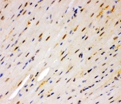 IHC staining of FFPE mouse heart tissue with MSK1 antibody. HIER: boil tissue sections in pH8 EDTA for 20 min and allow to cool before testing.