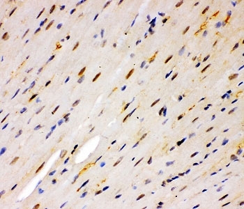IHC staining of FFPE mouse heart tissue with MSK1 antibody. HIER: boil tissue sections in pH8 EDTA for 20 min and allow to cool before testing.