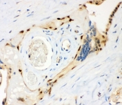 IHC staining of FFPE human placental tissue with MSK1 antibody. HIER: boil tissue sections in pH8 EDTA for 20 min and allow to cool before testing.
