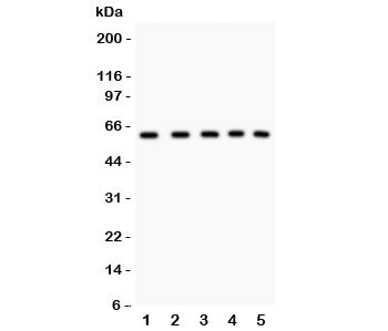 Western blot testing of LKB1 antibody and human samples 1: 293T; 2: HT1080; 3: SHG-44; 4: Jurkat; 5: placenta; Predicted molecular weight: 50~60 kDa~