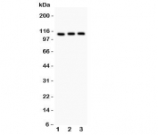 Western blot testing of TRPC5 antibody and Lane 1:  HeLa;  2: U87;  3: COLO320. Expected size ~111KD
