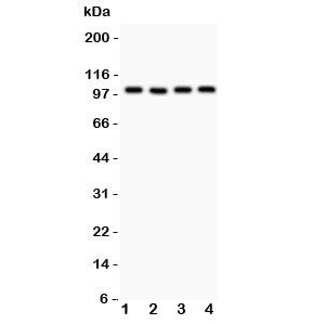 Western blot testing of TRPC7 antibody and Lane 1: mouse brain; 2: human A549; 3: (h) COLO320; 4: (h) SKOV. Expected size ~100KD~