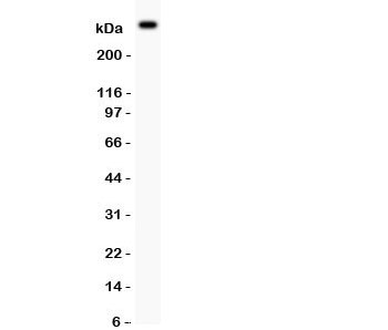 Western blot testing of von Willebrand Factor antibody and mouse lung tissue. Predicted molecular weight ~309KD
