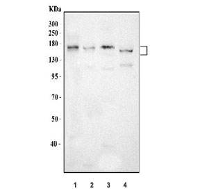 Western blot testing of 1) human HepG2, 2) rat liver, 3) rat RH35 and 4) mouse liver tissue lysate with ABCB4 antibody. Predicted molecular weight: 135-142 kDa (multiple isoforms).