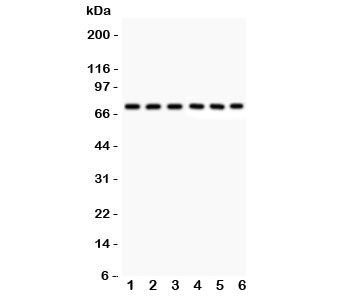 Western blot testing of Kininogen 1 antibody and human samples 1: U87; 2: MCF-7; 3: SKOV; 4: SW620; 5: COLO320; 6: placenta lysate. Predicted/observed size ~72KD (HMWK)
