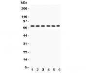 Western blot testing of Kininogen 1 antibody and human samples 1:  U87;  2: MCF-7;  3: SKOV;  4: SW620;  5: COLO320;  6: placenta lysate.  Predicted/observed molecular weight ~72kDa (HMWK).